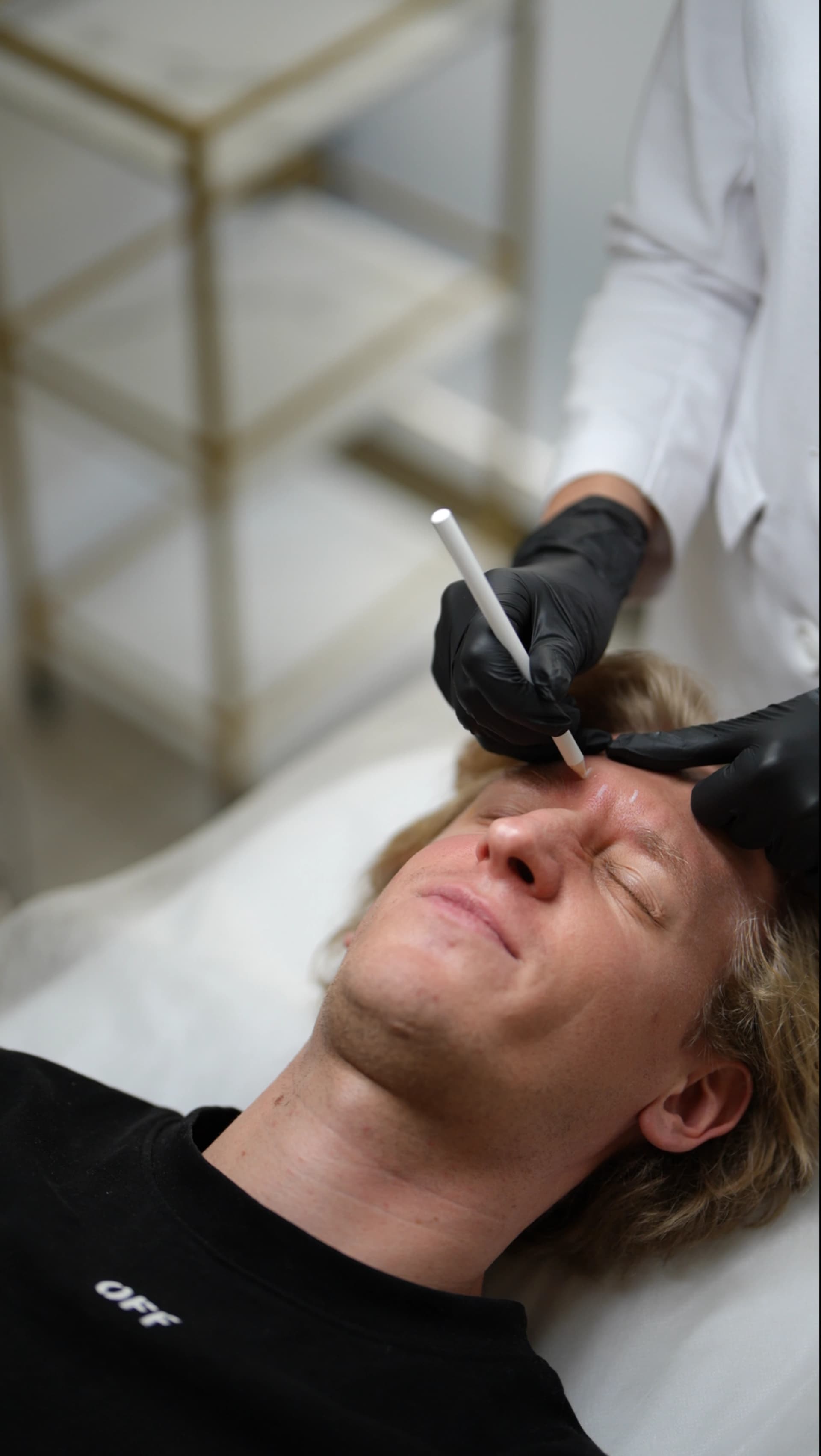 Consultation notes comparing Botox and tissue stimulators in an aesthetic clinic